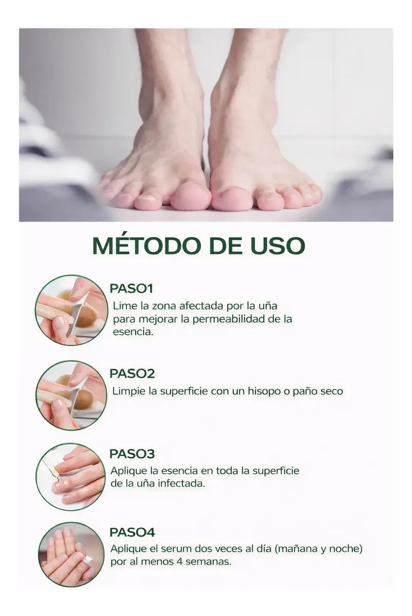 Ginger Shield™ tonico antifúngico uñas